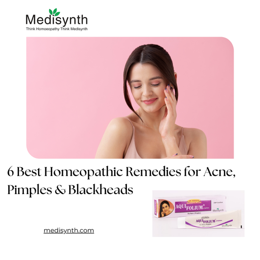 6 Best Homeopathic Remedies for Acne, Pimples & Blackheads