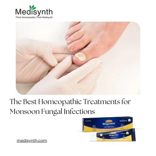 The Best Homeopathic Treatments for Monsoon Fungal Infections