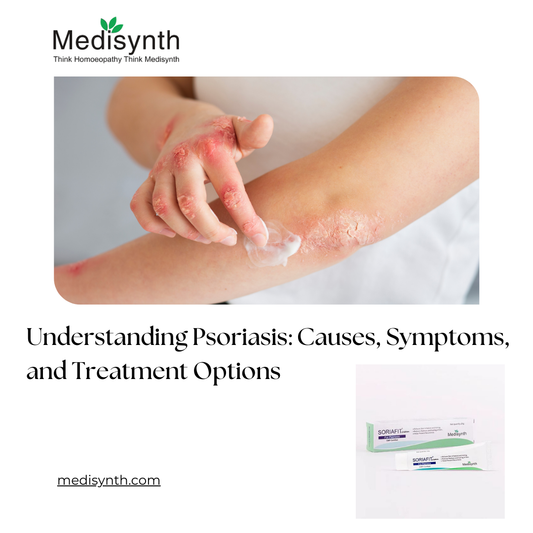 Understanding Psoriasis: Causes, Symptoms, and Treatment Options