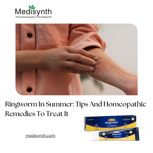 Ringworm In Summer: Tips And Homeopathic Remedies To Treat It