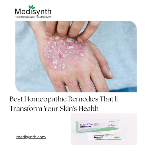 Best Homeopathic Remedies for Psoriasis