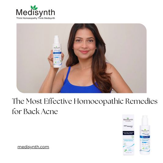 The Most Effective Homoeopathic Remedies for Back Acne