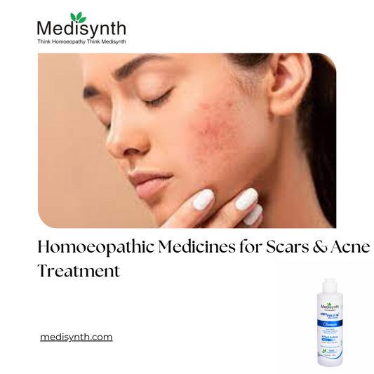 Homoeopathic Medicines for Scars & Acne Treatment