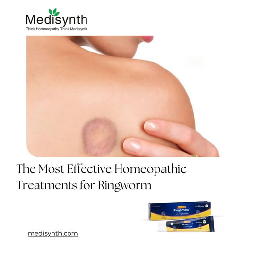 The Most Effective Homeopathic Treatments for Ringworm