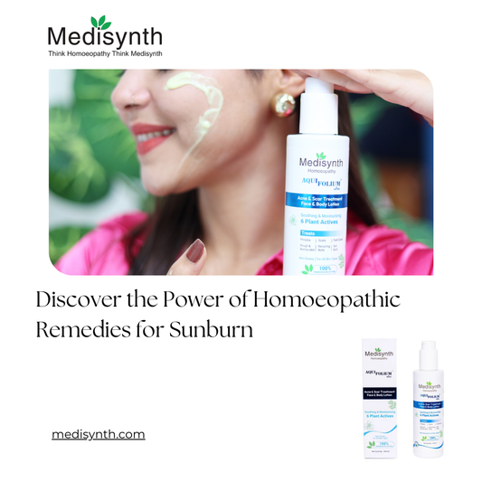 Discover the Power of Homoeopathic Remedies for Sunburn