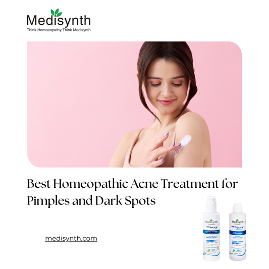 Best Homeopathic Acne Treatment for Pimples and Dark Spots