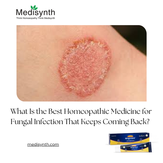 What Is the Best Homeopathic Medicine for Fungal Infection That Keeps Coming Back?