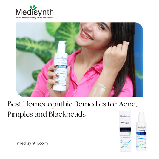 Best Homoeopathic Remedies for Acne, Pimples and Blackheads