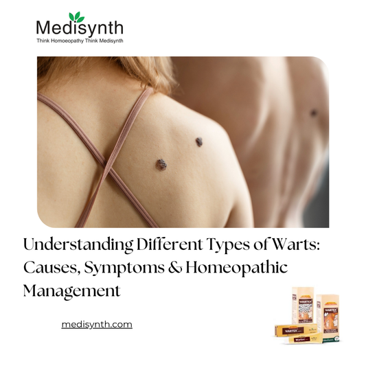 Understanding Different Types of Warts: Causes, Symptoms & Homeopathic Management