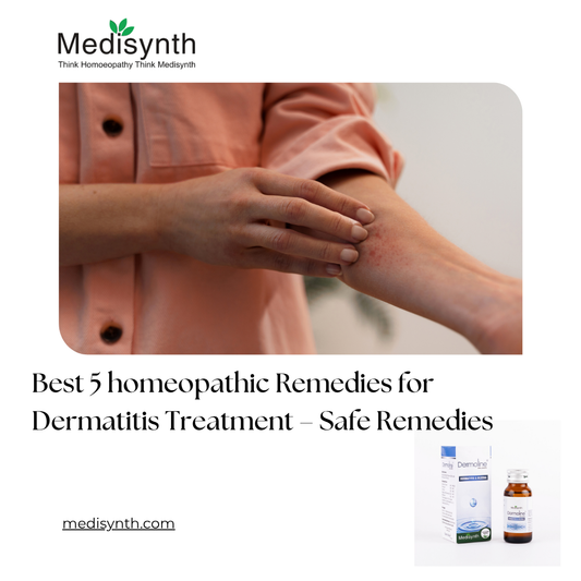 Best 5 homeopathic Remedies for Dermatitis Treatment – Safe Remedies