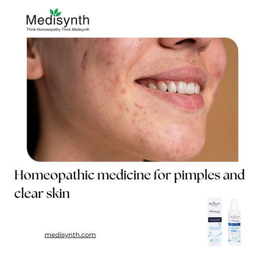 Homeopathic medicine for pimples and clear skin