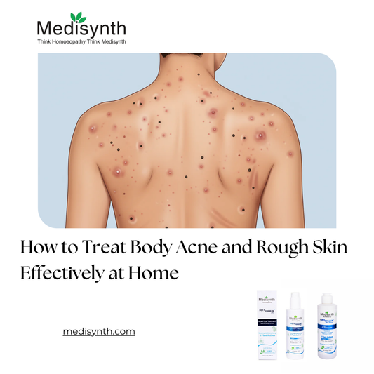 How to Treat Body Acne and Rough Skin Effectively at Home