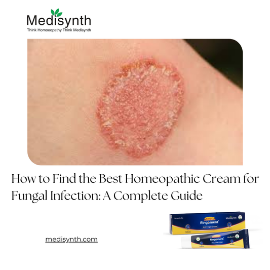 How to Find the Best Homeopathic Cream for Fungal Infection: A Complete Guide