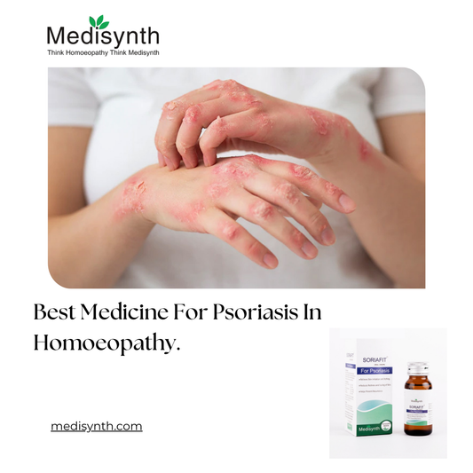 Best Medicine For Psoriasis In Homoeopathy