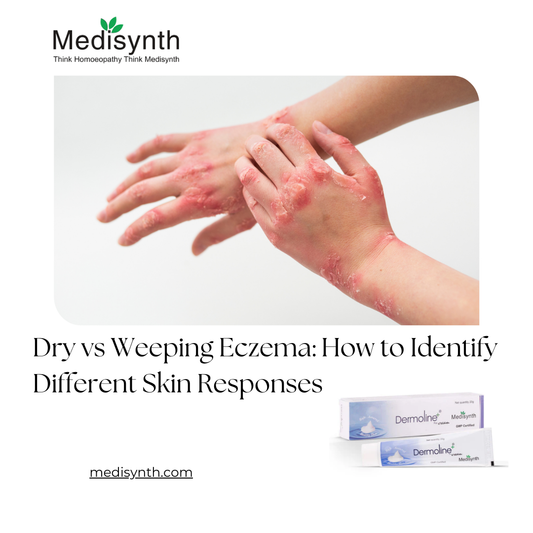 Dry vs Weeping Eczema: How to Identify Different Skin Responses