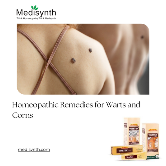 The Ultimate Homeopathic Remedies for Warts and Corns