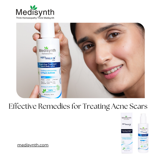 Effective Remedies for Treating Acne Scars