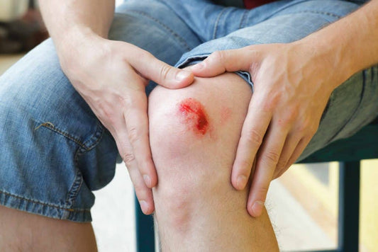 Top Homeopathic Remedies for Wounds