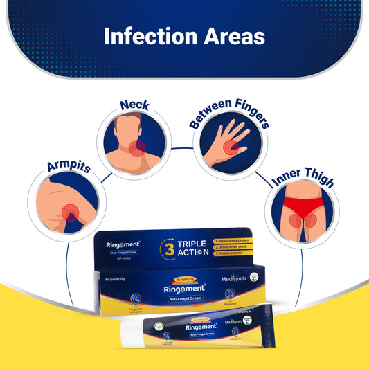 Ringoment Anti-Fungal Cream (Combo Pack of 2- 20g Each)